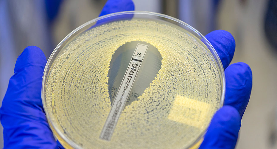 Petri dish in blue hand