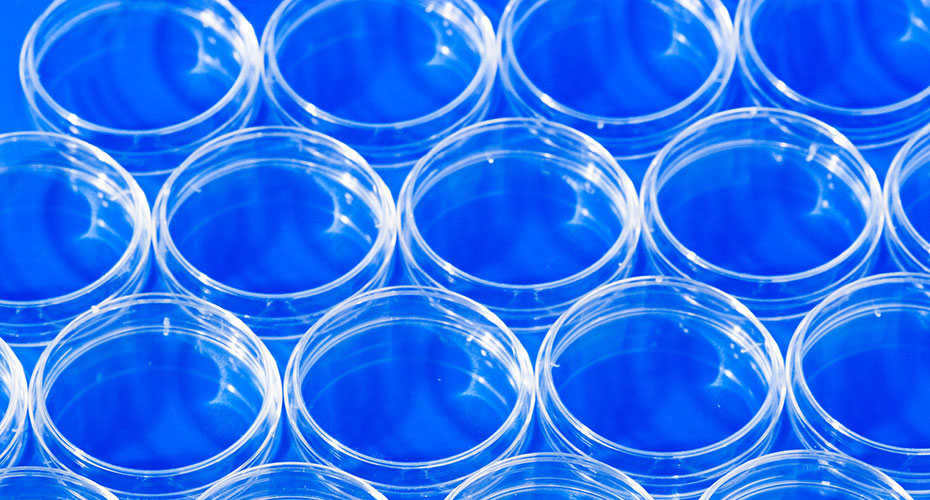 Blue lab petri dishes