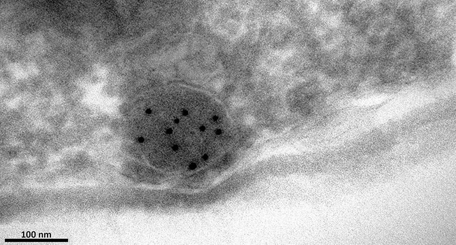 Transmission Electron Microscopy Techniques Immunogold labelling