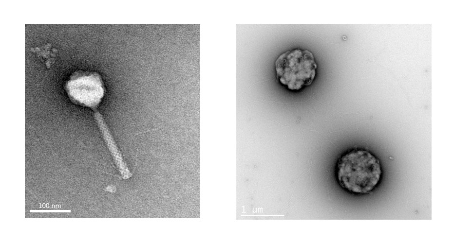 Negative staining  Transmission Electron Microscopy (TEM ) Techniques